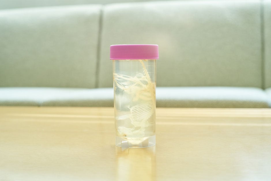 「透明化試薬」に漬けたマウスのサンプル。皮膚や臓器が透明化されている。この技術によって、細胞を一個ずつ一斉に観察することが可能になった。